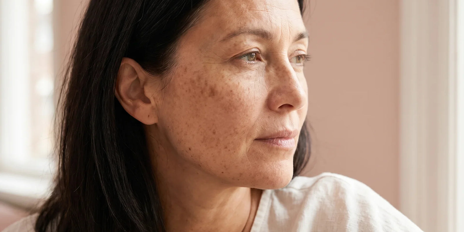 Gros plan sur le visage d'une femme avec des taches pigmentaires sur la pommette et la tempe