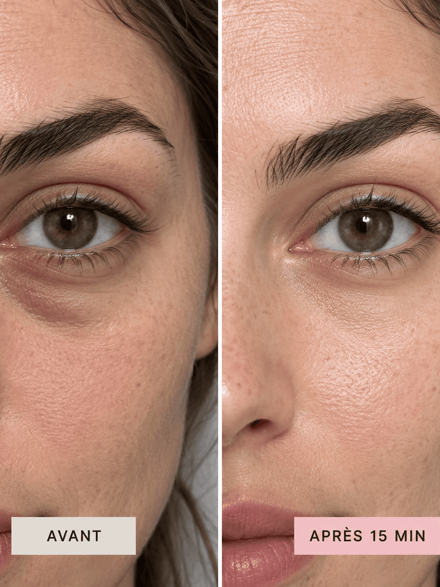 Patchs yeux anti-cernes et anti-poches à la caféine et vitamine C