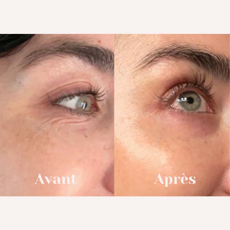 Glowy™ Eyes - Soin Anti-âge du contour des yeux au filtrat de mucine d'escargot