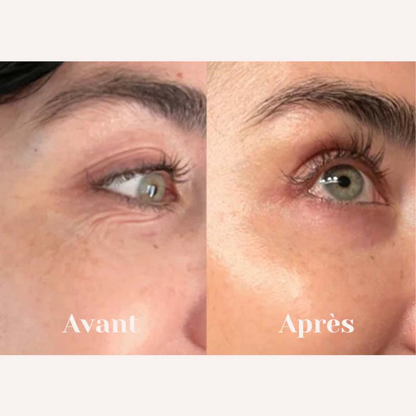 Glowy™ Eyes - Soin Anti-âge du contour des yeux au filtrat de mucine d'escargot