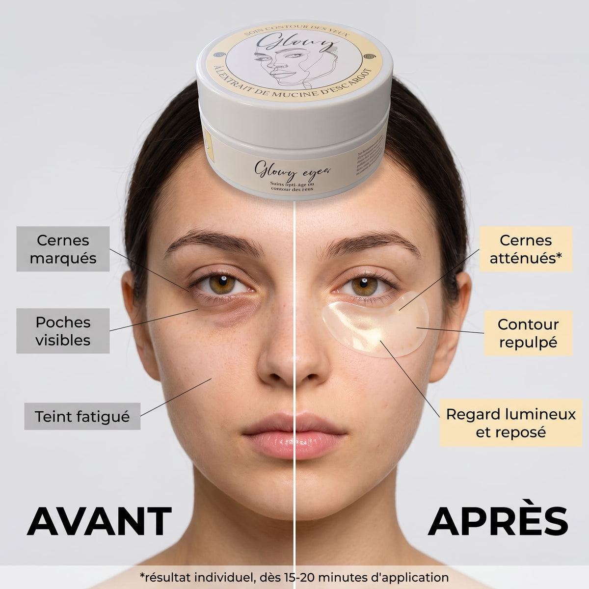 Ridules du contour de l'œil avant et après les patchs Glowy Eyes