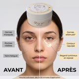 Ridules du contour de l'œil avant et après les patchs Glowy Eyes