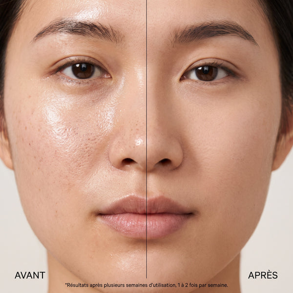Masque à l'Argile Naturelle pour Pores et Points Noirs
